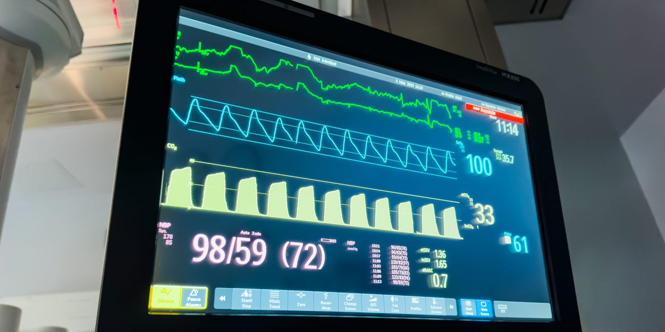 Are usual vasopressor doses causing unrecognized harm?