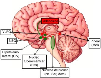 Trastornos del sueño en el traumatismo craneoencefálico - ScienceDirect