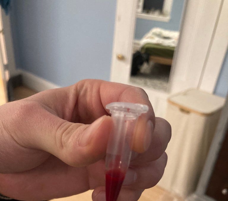 How to sequence your DNA for <$2k