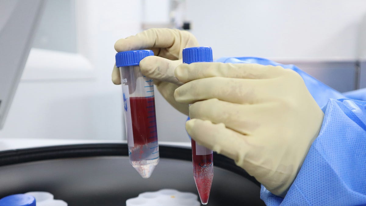 Why I Check Estradiol Levels After Hormone Therapy Begins