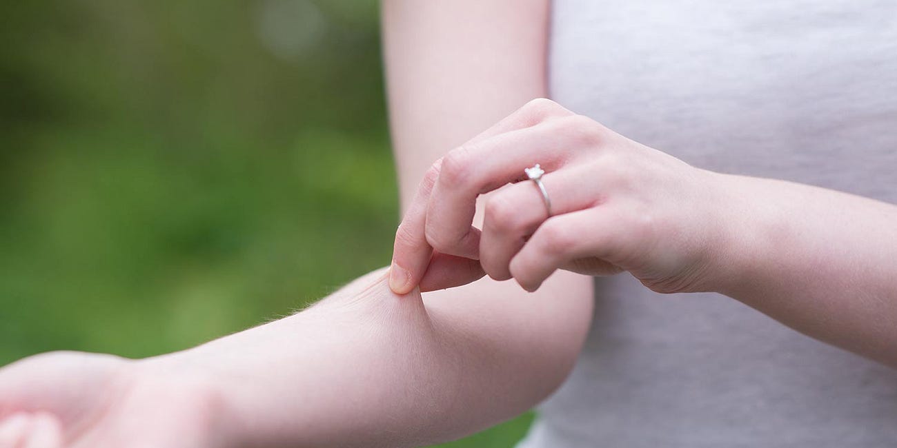 Ehlers-Danlos Syndrome Shines Light on Our Most Sensory Organ 