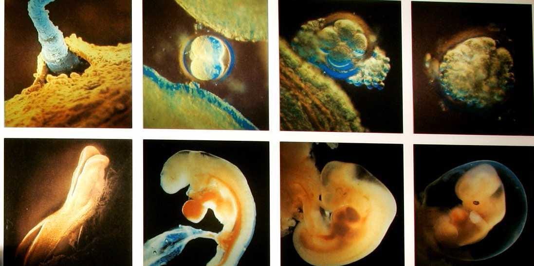 The Nefarious Goal Behind Covid Testing