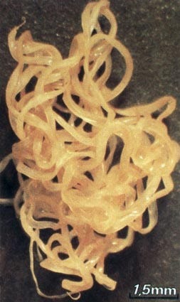 Onchocerca volvulus | SpringerLink