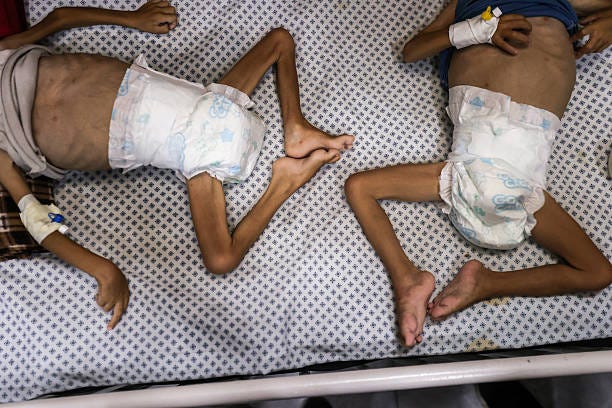 Three-year-old Mohammed Mehreh and his four-year-old brother Oday Mehreh receiving treatment at Patient Friends Association Hospital are in critical...