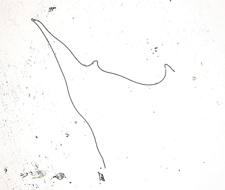 And More 'Things' in urine samples