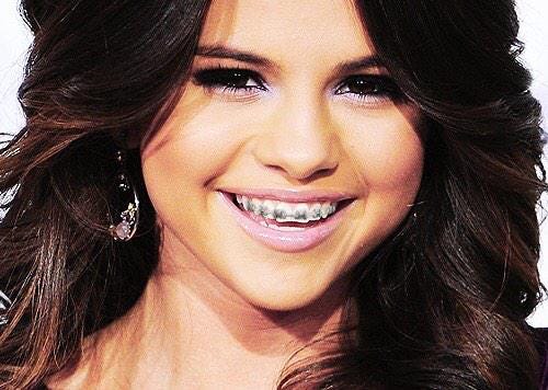 Celebs With Braces on X: "Selena Gomez http://t.co/oOIfoBsmum" / X