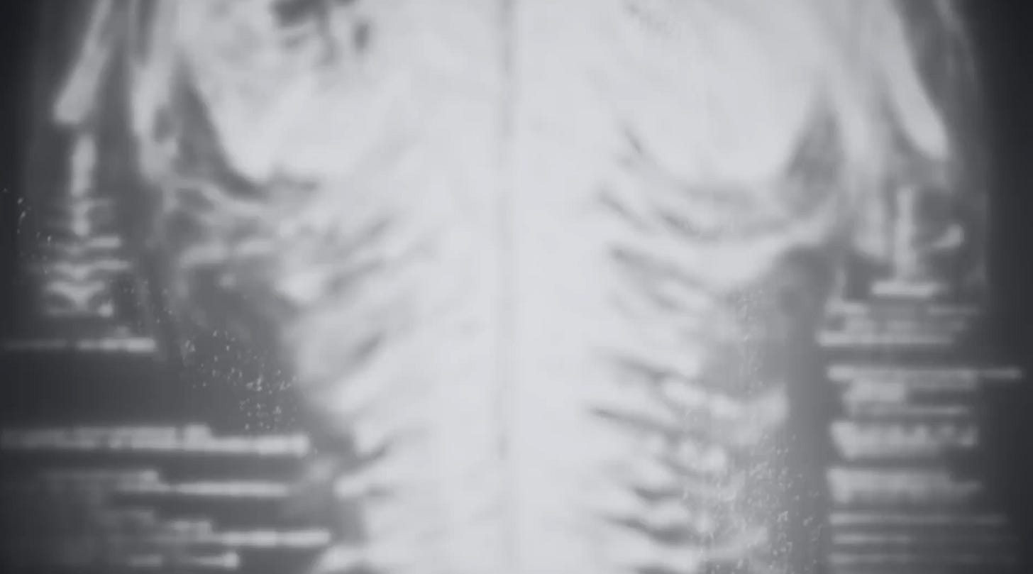 An extremely fuzzy shot of a T-shaped white blob on a dark grey background. Lines on either side give the impression of blurry text.