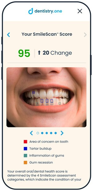 In less than a minute, SmileScan™ analyzes user-submitted photos and delivers a report flagging potential signs of common dental concerns, such as plaque, inflammation, and crowding.