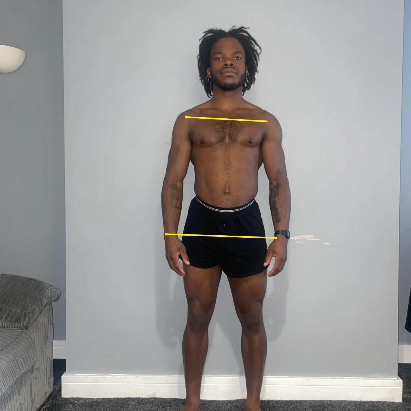 Showing person with one shoulder sitting lower than the other, demonstrating visible shoulder asymmetry and postural imbalance