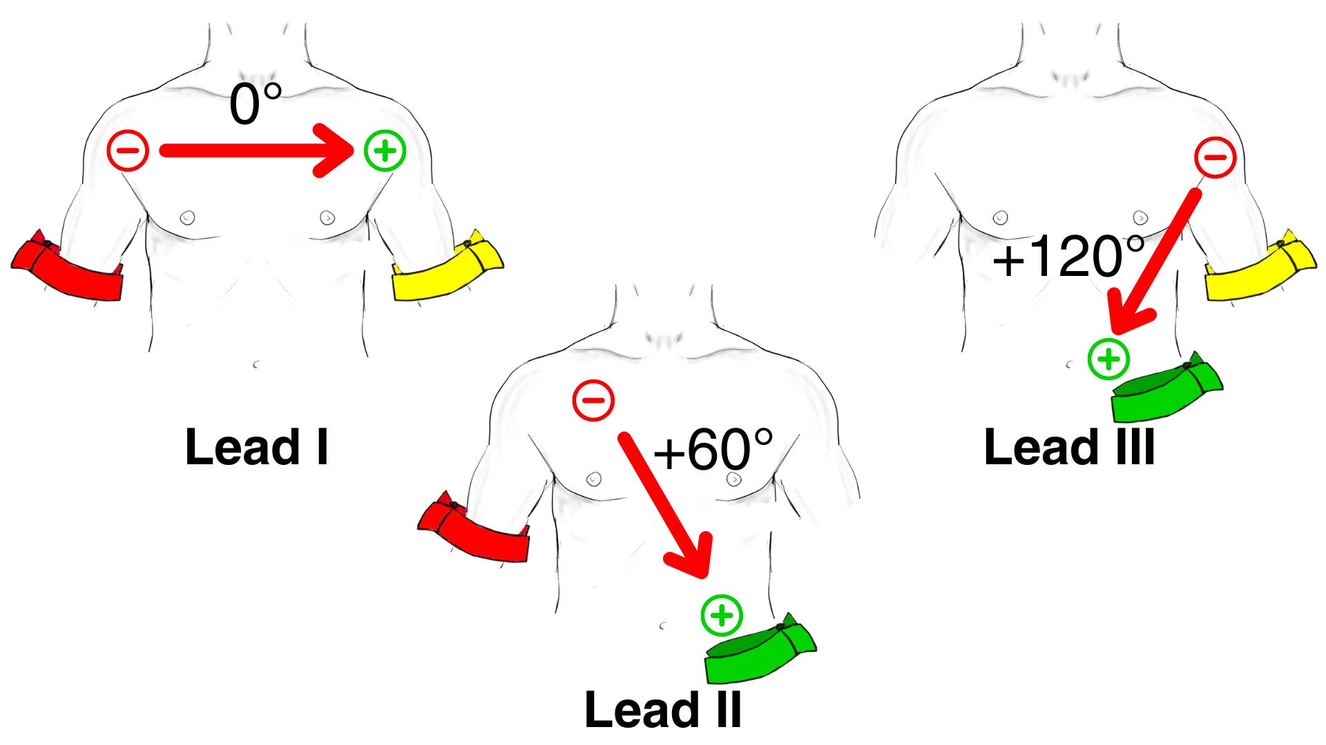Ecg Leads Limb