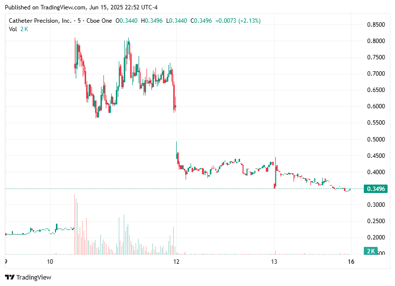 TradingView chart TradingView chart