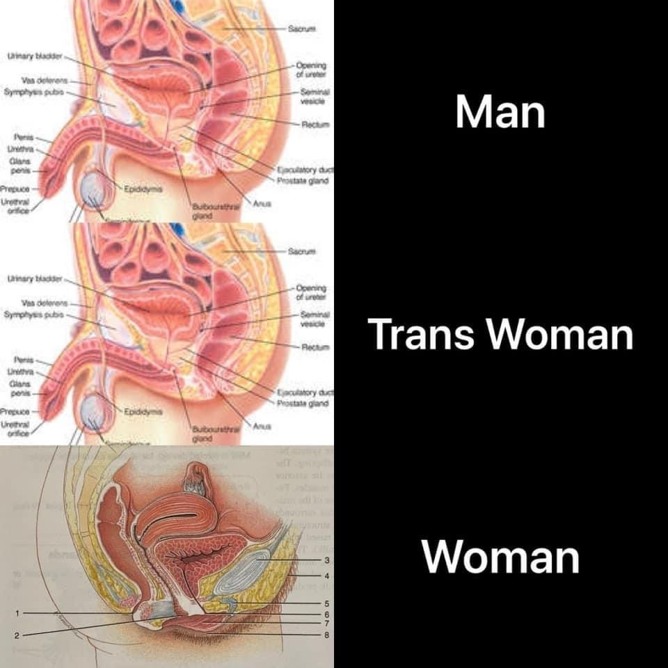 Former Libtard