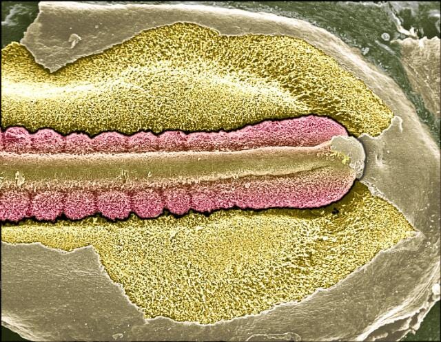 Chick embryo showing the neural tube and developing somites. Somites (pink) are discreet bundles of tissue that form from mesoderm in an anterior (left) to posterior (right) direction. They go on to give rise to the vertebrae, muscles and dermis. The neural tube (centre) will develop into the spinal cord.