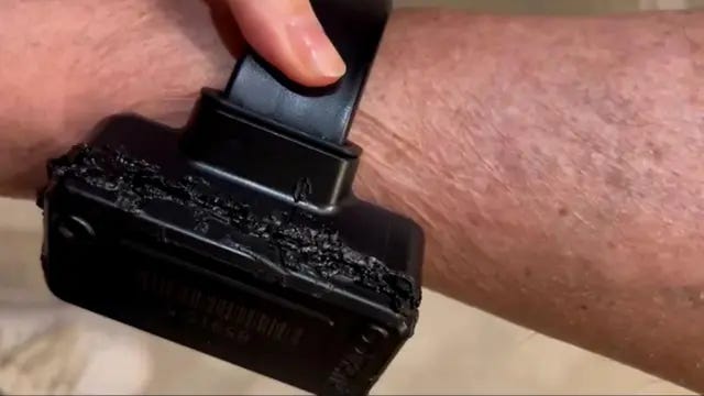 Bolsonaro diz que usou ferro de solda na tornozeleira