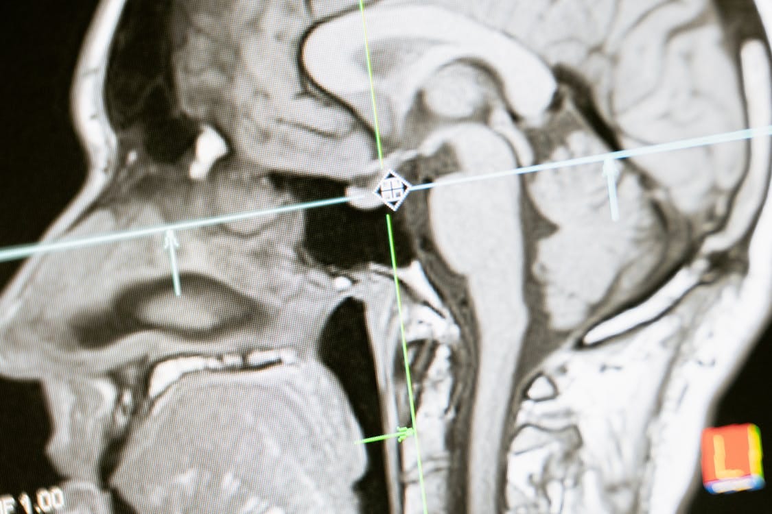 Free Close-up of an MRI scan showing a sagittal view of the human brain for analysis. Stock Photo Free Close-up of an MRI scan showing a sagittal view of the human brain for analysis. Stock Photo