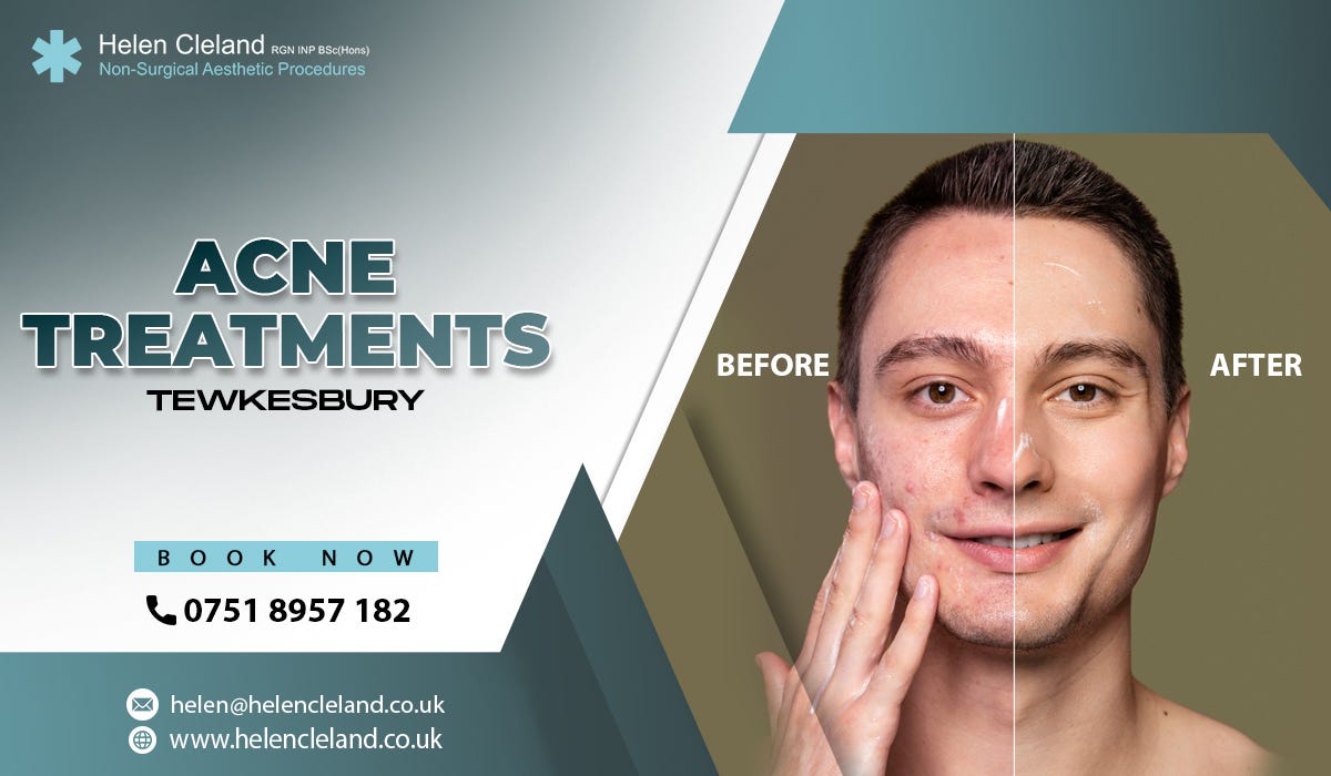 Acne treatments Tewkesbury