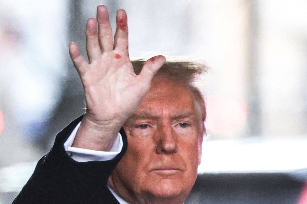 What are the mysterious red marks on Donald Trump's hand? | South China Morning Post What are the mysterious red marks on Donald Trump's hand? | South China Morning Post