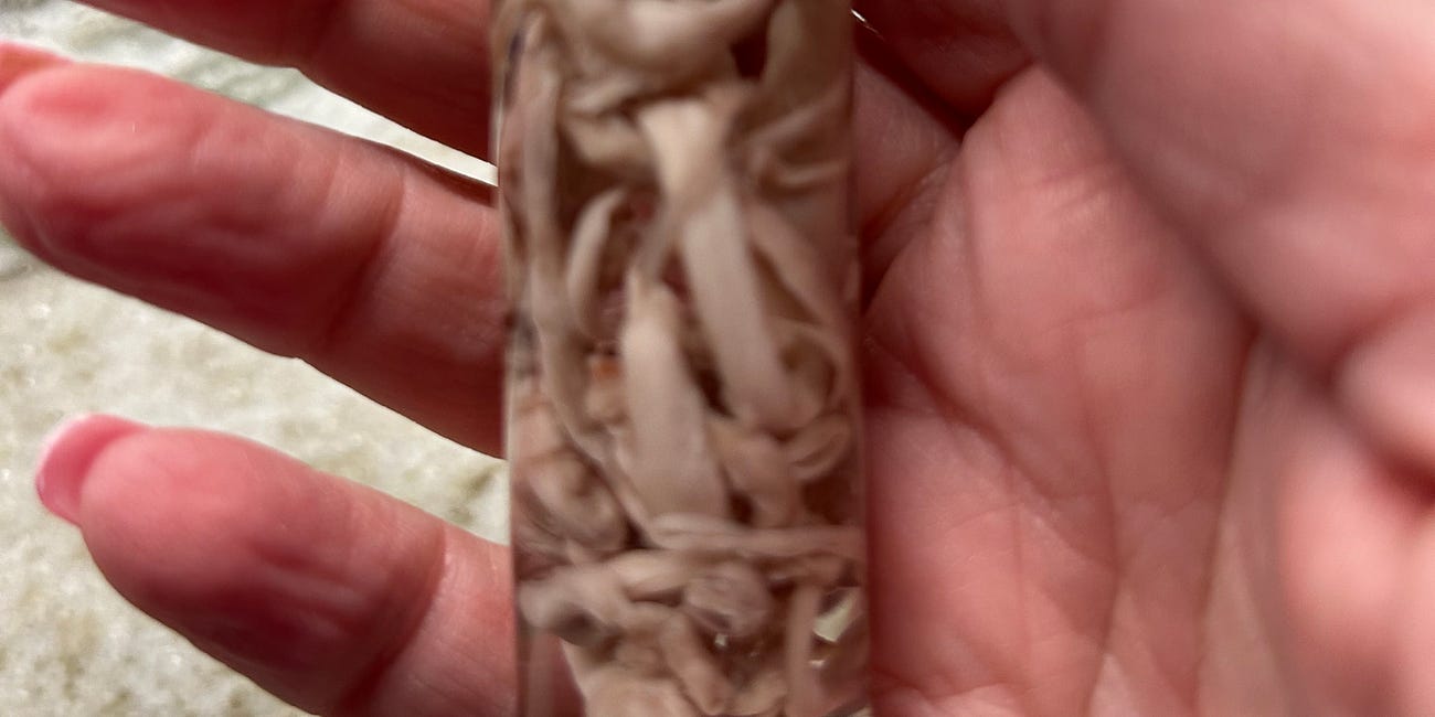 EMBALMER BLOOD CLOTS