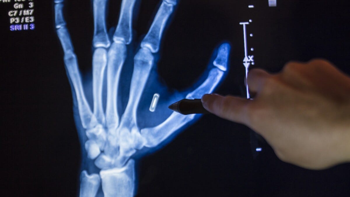 Chip-and-skin: Implantable RFID gives payments its Matrix moment |  PaymentsSource | American Banker