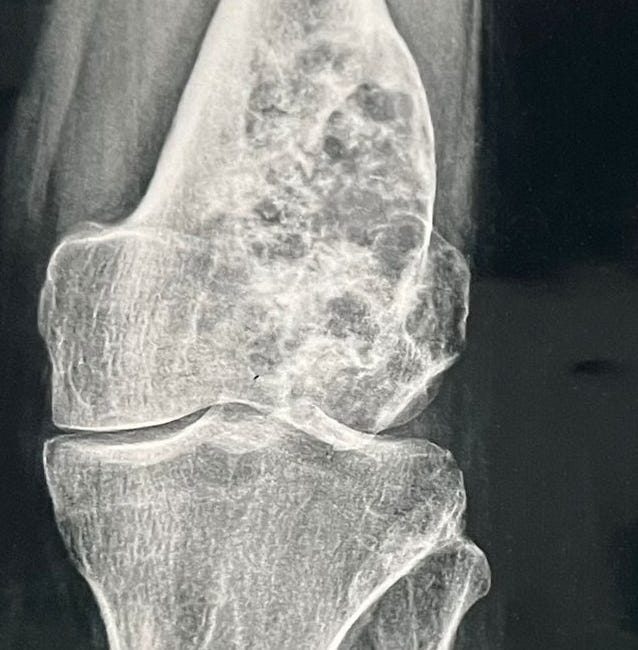 Case 68: Identifying the Correct Matrix on Radiographs