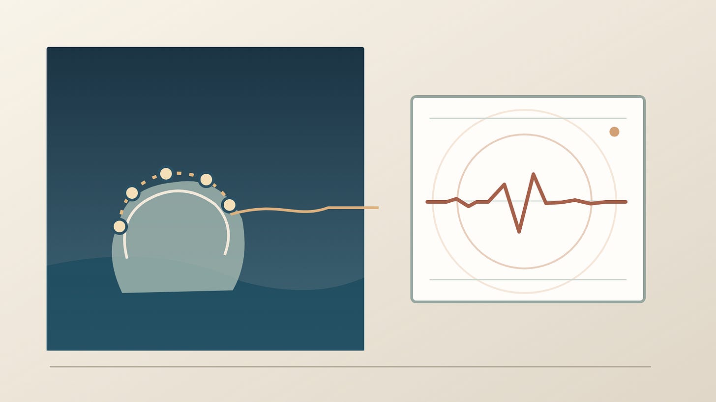 Illustration of scalp electrodes connected to a signal display.
