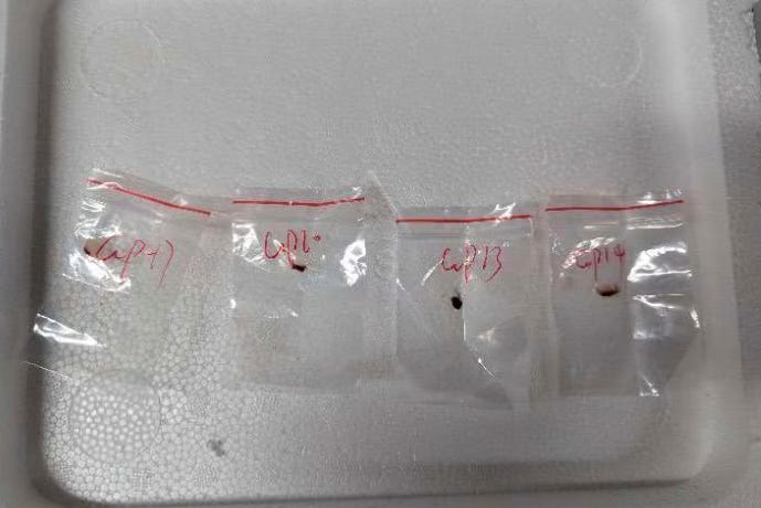 Bureaucratic Lapse, Not Bioterror: The Overblown Fungus Smuggling Case