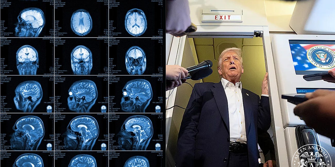 Trump’s Brain Problem: The MRI Denial, the Slip-Ups, and a White House Hiding the Truth