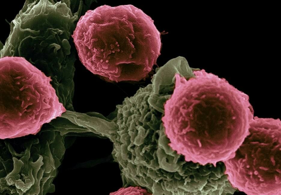 Como prevenir y combatir el cáncer naturalmente