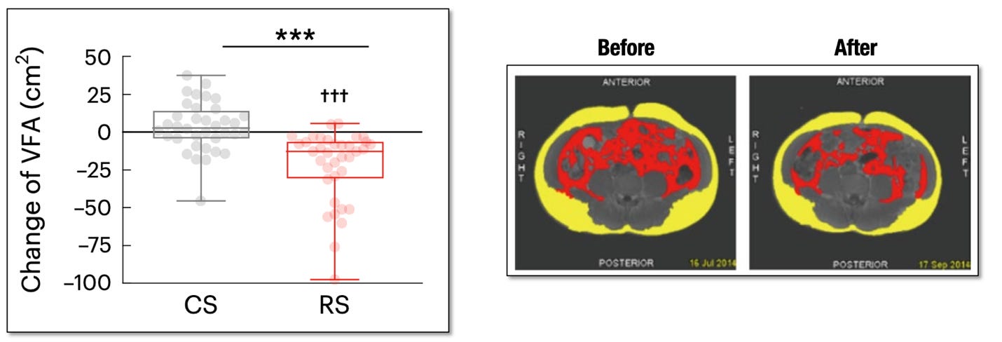 A close-up of a scan

AI-generated content may be incorrect.
