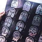 Research Hit: Transcendental Thinking Can lead to Bigger Brains and Higher Life Satisfaction