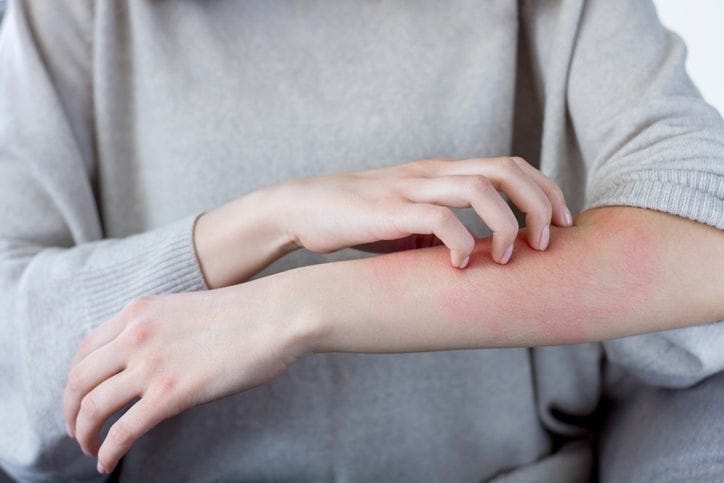 Can Clothing Fabric Cause Dermatitis? | VitalSkin Dermatology