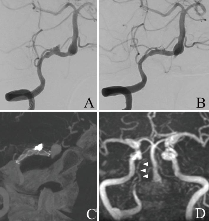 An external file that holds a picture, illustration, etc.
Object name is 2188-4226-9-0095-g004.jpg