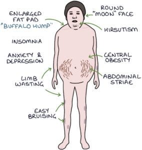 Cortisol and the Adrenal Axis – Zero To Finals Cortisol and the Adrenal Axis – Zero To Finals