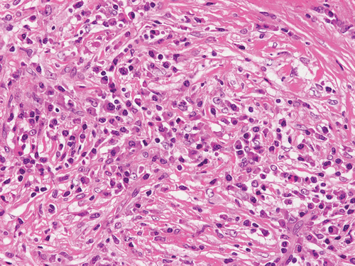 Figure 1c.