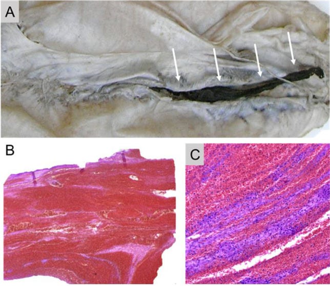 An external file that holds a picture, illustration, etc.
Object name is 414_2021_2706_Fig2_HTML.jpg