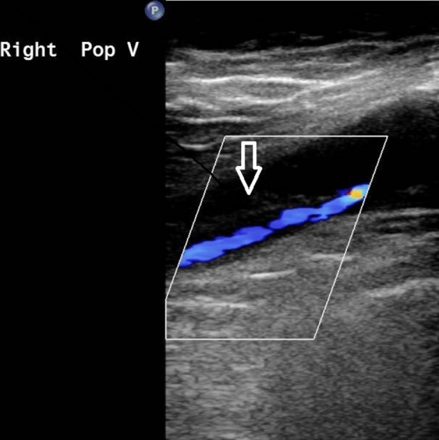 An external file that holds a picture, illustration, etc.
Object name is acs-38-539-g002.jpg An external file that holds a picture, illustration, etc.
Object name is acs-38-539-g002.jpg