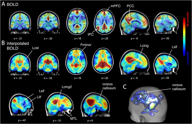 Structural mediation of human brain activity revealed by white-matter  interpolation of fMRI - ScienceDirect