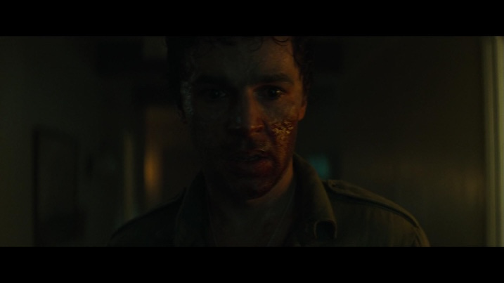 Christopher Abbott in Wolf Man — Close-up of Christopher Abbott as the infected father, his face scarred and bloodied during transformation.
