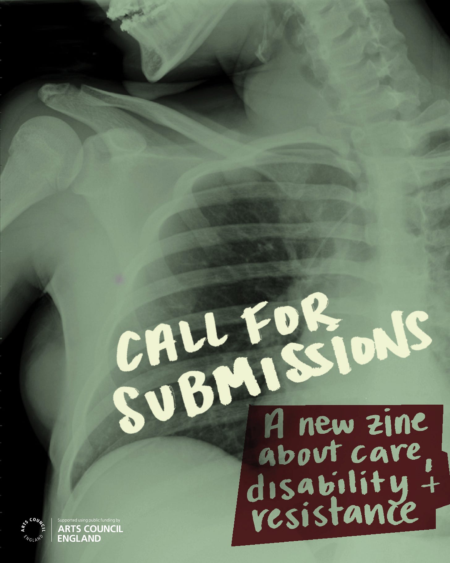 text reading “call for submissions: a new zine about disability, care and resistance” overlaid on an xray of Molly’s lungs when they were younger. In the image, you can see they have braces