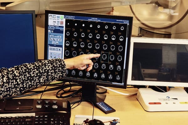 A hand points to a computer screen on a desk with many small scans of a human brain on it.