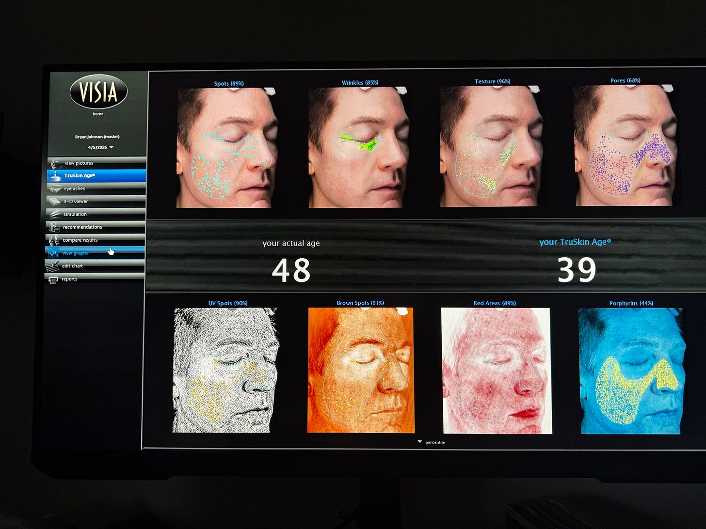 Results from my Feb 23 skin therapy: - Bryan Johnson