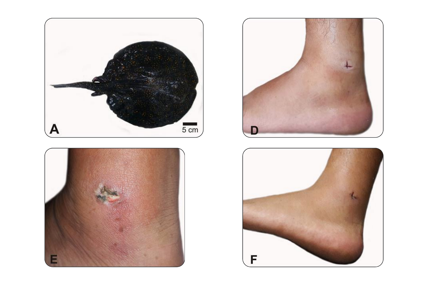 (Reprodução: J. Bioen. Food Sci., v.4, n.2, pp.78-80, 2017)