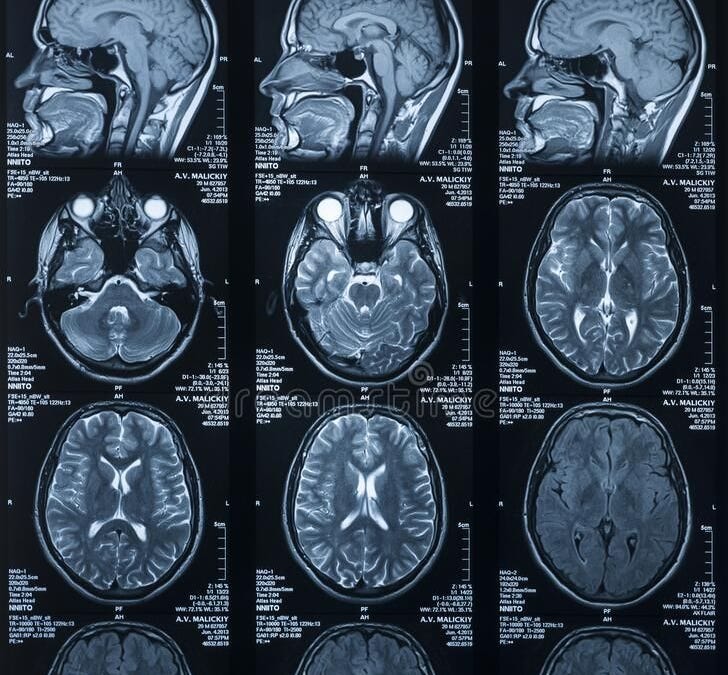 Why Does My Brain Keep Choosing What Makes Me Feel Worse?