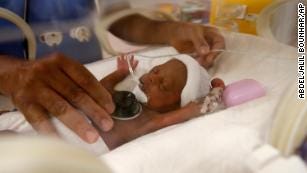 A pediatrician examines with a stethoscope one of the nine babies at the Ain Borja clinic in Casablanca, Morocco on May 20, 2021.