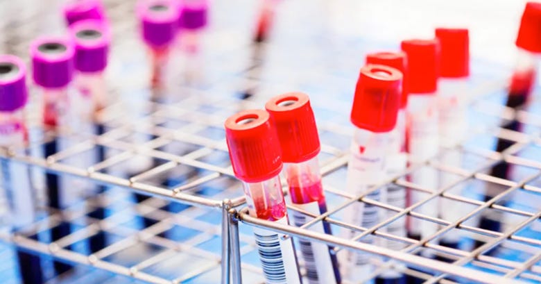 A group of test tubes in a rack

Description automatically generated