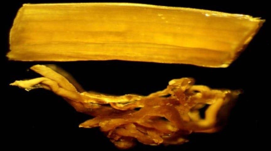 Two new papers on the embalmer's clots