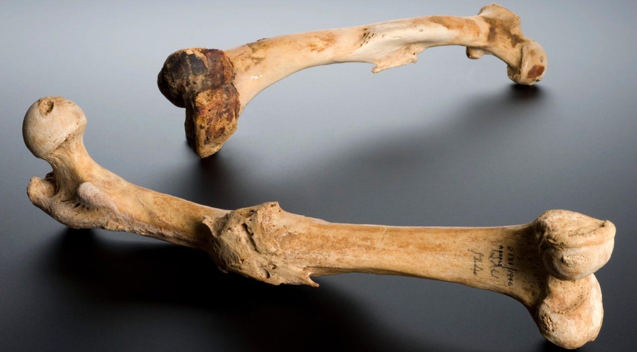 Human left femur, Tell Fara, Palestine, 100 BCE-200 CE. Science Museum, London. Attribution 4.0 International (CC BY 4.0)