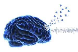 Early hallucinations in Parkinson's disease are associated with frontal cognitive decline (triangles), and preceded by specific frontal neural oscillation (theta frequency band).