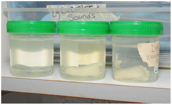 Baby feet in jars, from Kermit Gosnell's abortion facility
