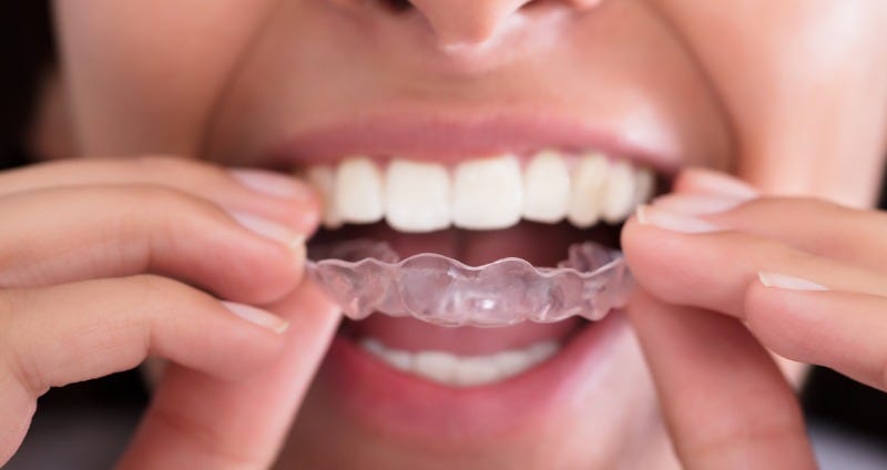 Retainers After Braces | Types, Importance & Care | The Orthodontist
